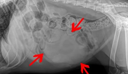 abdominal_1abdominal X-Ray