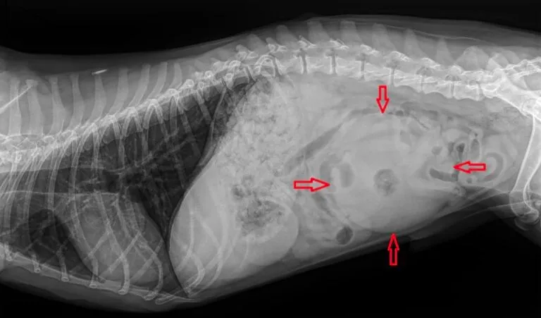 cancer_2 X-ray